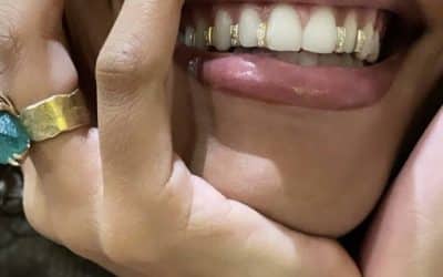 Grillz… du bling-bling à la joaillerie